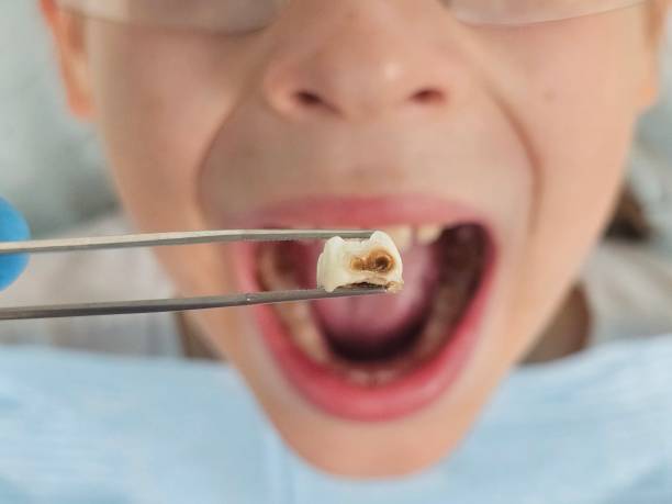 Best Walk-In Emergency Dentist in Bolindale, OH